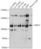 Cell Biology Antibodies 13 Anti-TRPC7 Antibody CAB17738