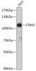 Cell Biology Antibodies 13 Anti-STIM2 Antibody CAB17743