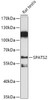 Cell Biology Antibodies 16 Anti-SPATS2 Antibody CAB17762