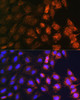 KO Validated Antibodies 1 Anti-SLC25A22 Antibody CAB17772KO Validated