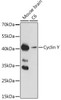 Cell Biology Antibodies 15 Anti-Cyclin Y Antibody CAB17845