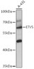 Cell Biology Antibodies 15 Anti-ETV5 Antibody CAB17927