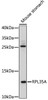 Cell Biology Antibodies 14 Anti-RPL35A Antibody CAB17938