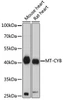 Cell Biology Antibodies 14 Anti-MT-CYB Antibody CAB17966