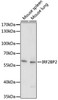Cell Biology Antibodies 14 Anti-IRF2BP2 Antibody CAB17985
