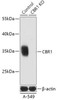 KO Validated Antibodies 1 Anti-CBR1 Antibody CAB18074KO Validated