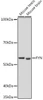 Immunology Antibodies 3 Anti-FYN Antibody CAB18127