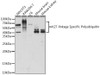 Cell Biology Antibodies 14 Anti-K27-linkage Specific Polyubiquitin Antibody CAB18202