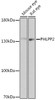 Cell Biology Antibodies 18 Anti-PHLPP2 Antibody CAB18218