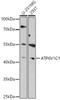 Cell Biology Antibodies 18 Anti-ATP6V1C1 Antibody CAB18253