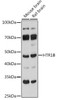 Cell Biology Antibodies 18 Anti-HTR1B Antibody CAB18285