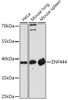 Cell Biology Antibodies 17 Anti-ZNF444 Antibody CAB18470