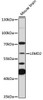 Cell Biology Antibodies 15 Anti-LEMD2 Antibody CAB18558