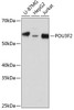Cell Biology Antibodies 15 Anti-POU3F2 Antibody CAB18576