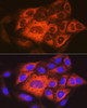 Cell Biology Antibodies 15 Anti-TACC3 Antibody CAB18641