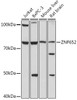 Cell Biology Antibodies 15 Anti-ZNF652 Antibody CAB18657