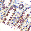 KO Validated Antibodies 2 Anti-SAV1 Antibody CAB18667KO Validated