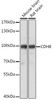 Cell Biology Antibodies 15 Anti-CDH8 Antibody CAB18691