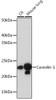 Immunology Antibodies 3 Anti-Caveolin-1 Antibody CAB19006