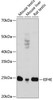 Immunology Antibodies 3 Anti-EIF4E Antibody CAB19044