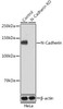 KO Validated Antibodies 2 Anti-N-Cadherin Antibody KO Validated CAB19083