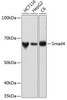 KO Validated Antibodies 2 Anti-Smad4 Antibody KO Validated CAB19116