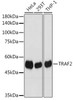 Cell Death Antibodies 2 Anti-TRAF2 Antibody CAB19129