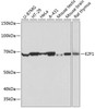 Cell Death Antibodies 2 Anti-E2F1 Antibody CAB19579