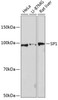 Cell Biology Antibodies 17 Anti-SP1 Antibody CAB19649