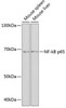 KO Validated Antibodies 2 Anti-NF-kB p65 Antibody KO Validated CAB19653