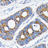 KO Validated Antibodies 2 Anti-Bax Antibody KO Validated CAB19684