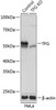 KO Validated Antibodies 2 Anti-TFG Antibody CAB19858KO Validated