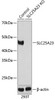 KO Validated Antibodies 2 Anti-SLC25A23 Antibody CAB19877KO Validated