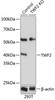 KO Validated Antibodies 2 Anti-TWF2 Antibody CAB19897KO Validated