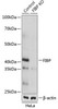 KO Validated Antibodies 2 Anti-FIBP Antibody CAB19908KO Validated