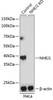 KO Validated Antibodies 2 Anti-NHEJ1 Antibody CAB19957KO Validated
