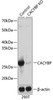 KO Validated Antibodies 2 Anti-CACYBP Antibody CAB20004KO Validated