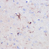 Cell Biology Antibodies 17 Anti-Iba1 Antibody CAB3160