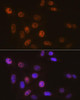 KO Validated Antibodies 2 Anti-SNF5 Antibody KO Validated CAB3247