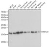 Cell Biology Antibodies 17 Anti-RPS19 Antibody CAB3675