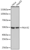 Cell Biology Antibodies 17 Anti-PKA R2 Antibody CAB3889