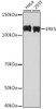 Cell Cycle Antibodies 2 Anti-ERK5 Antibody CAB3948