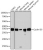 Cell Cycle Antibodies 2 Anti-Cyclin D3 Antibody CAB3989
