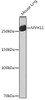 Cell Biology Antibodies 17 Anti-MYH11 Antibody CAB4064