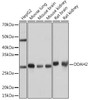 Cell Biology Antibodies 17 Anti-DDAH2 Antibody CAB4159