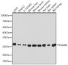 Metabolism Antibodies 3 Anti-PGAM1 Antibody CAB4170