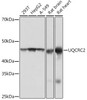 Cell Biology Antibodies 17 Anti-UQCRC2 Antibody CAB4366