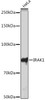 Immunology Antibodies 3 Anti-IRAK1 Antibody CAB4439