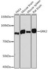 KO Validated Antibodies 2 Anti-GRK2 KO Validated Antibody CAB4443