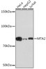 KO Validated Antibodies 2 Anti-MTA2 KO Validated Antibody CAB4624